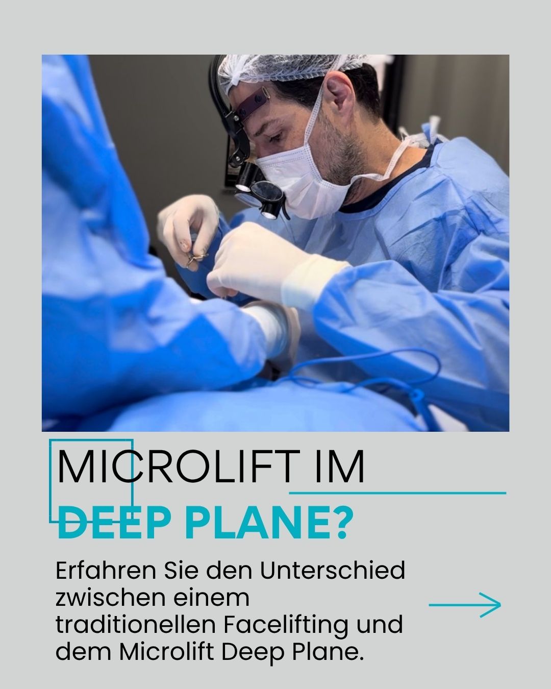 Wird der Microlift im Deep Plane durchgeführt? Erfahren Sie den Unterschied zwischen einem traditionellen Facelifting und dem Microlift Deep Plane.