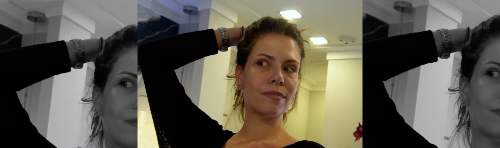 Resultado Microlift B