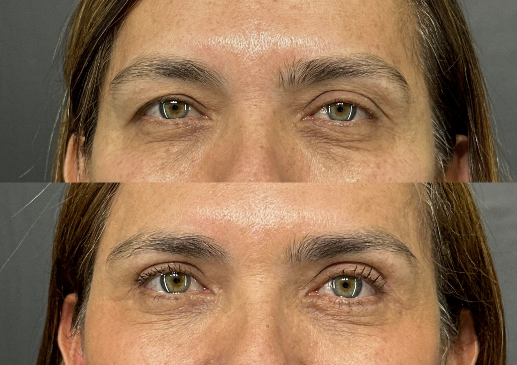 Before and after — Photo 1