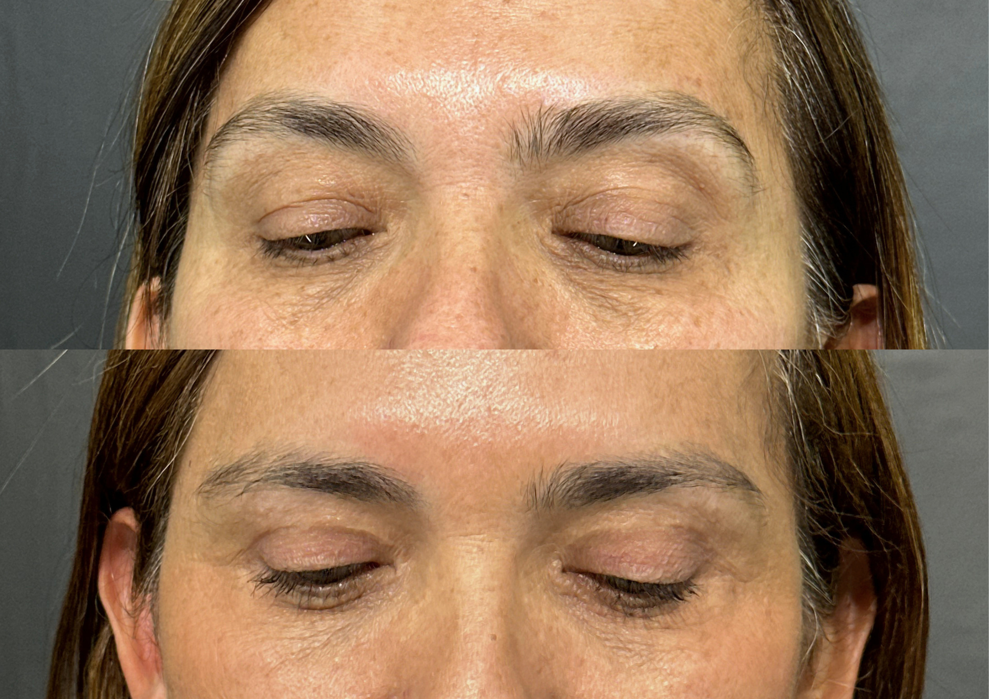 Before and after — Photo 2