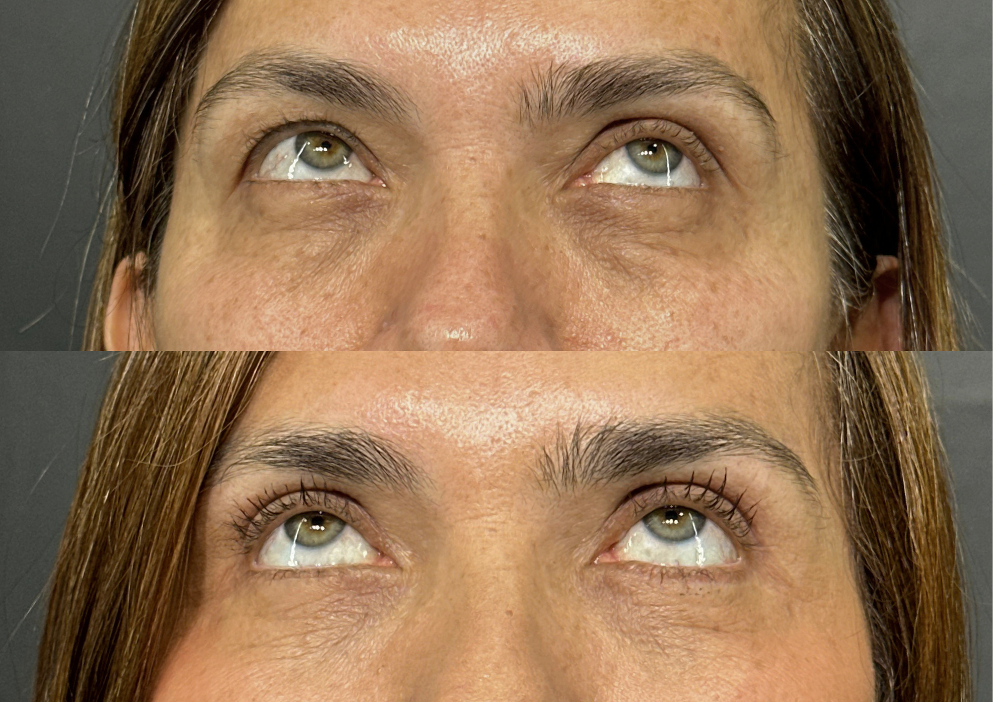 Before and after — Photo 3