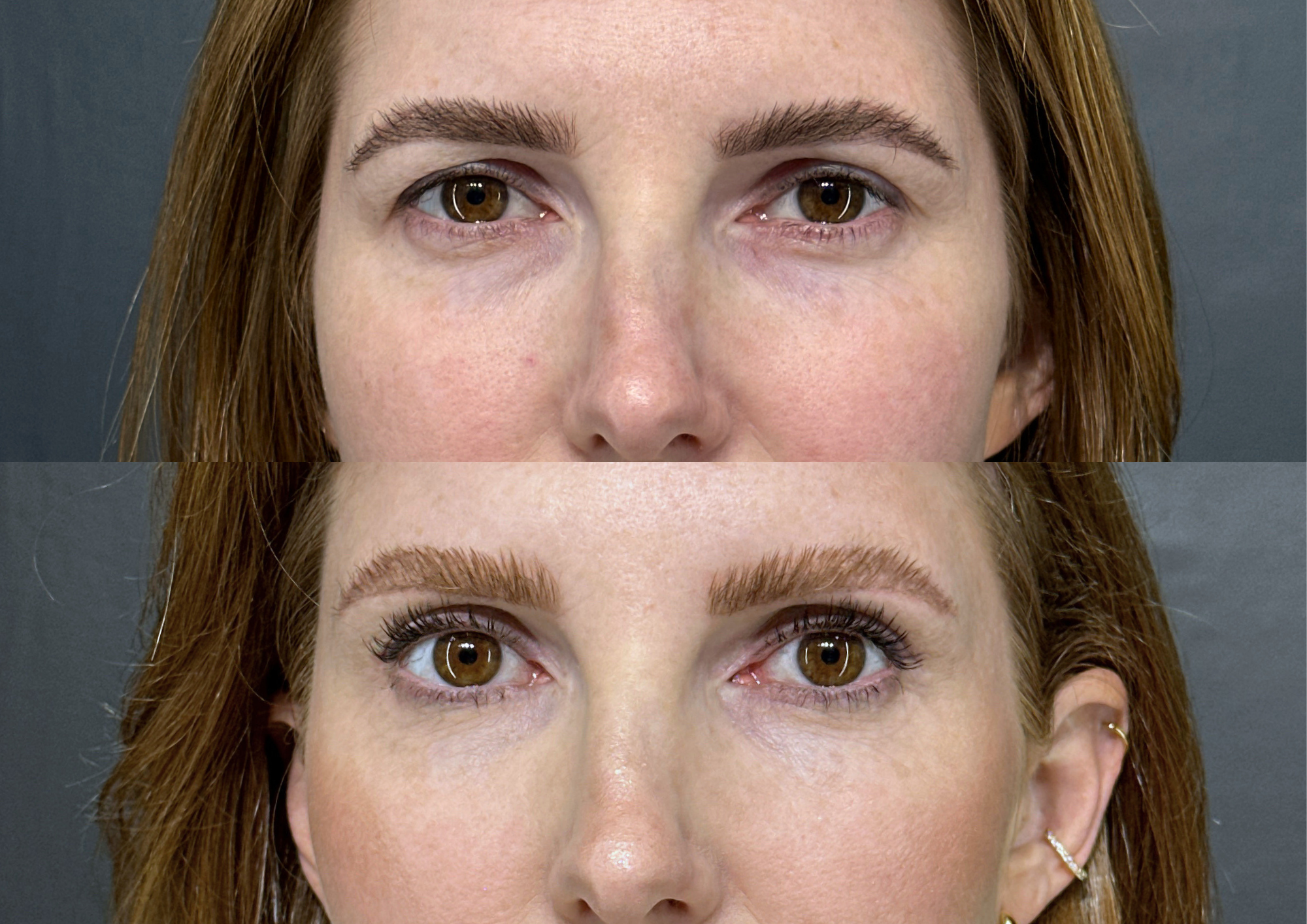 Before and after — Photo 1