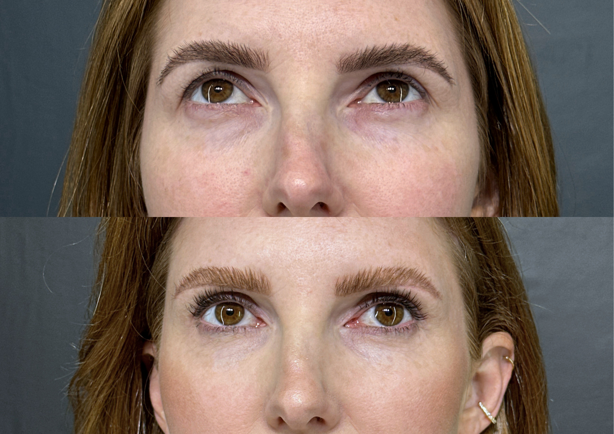 Before and after — Photo 3
