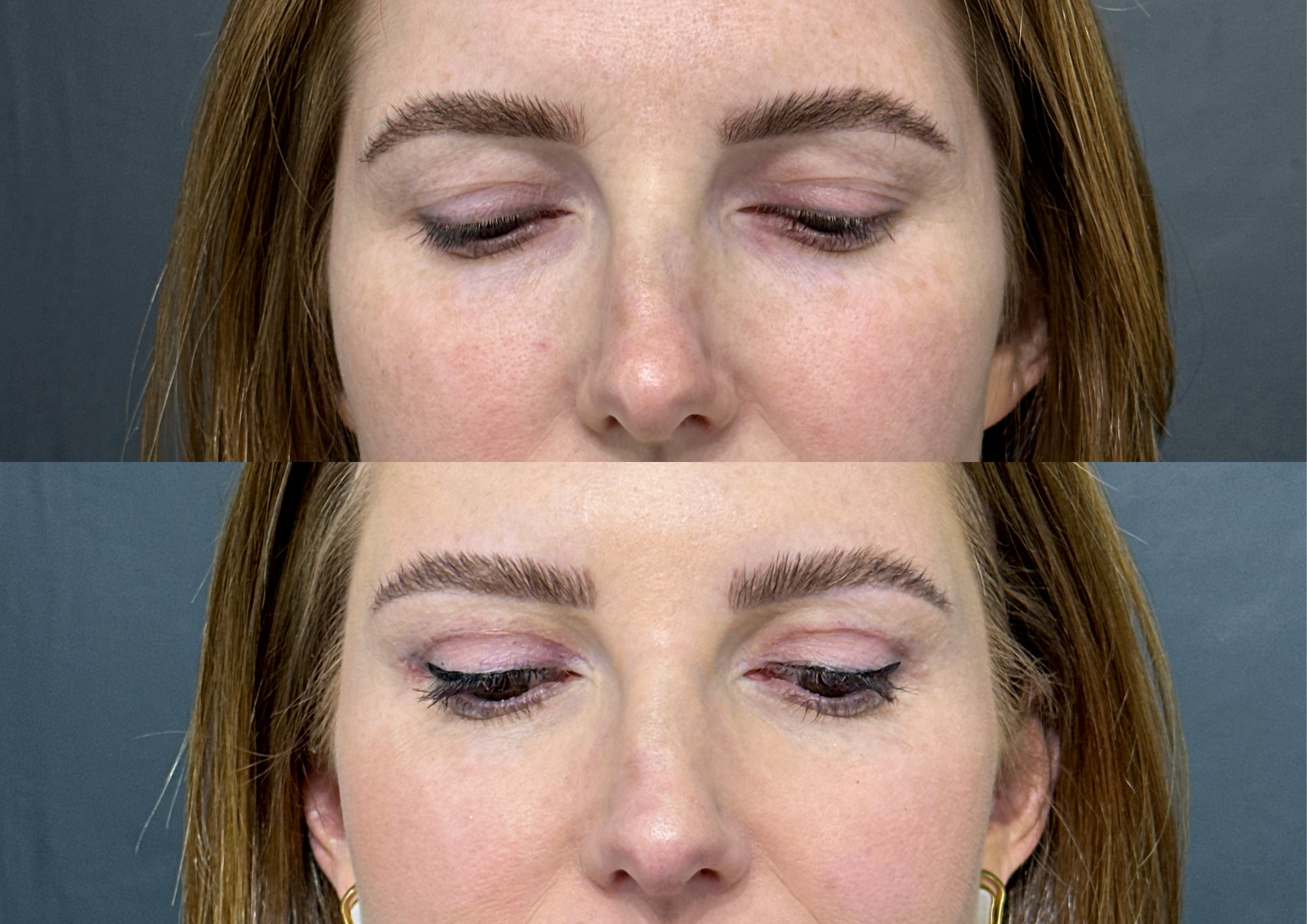 Before and after — Photo 2