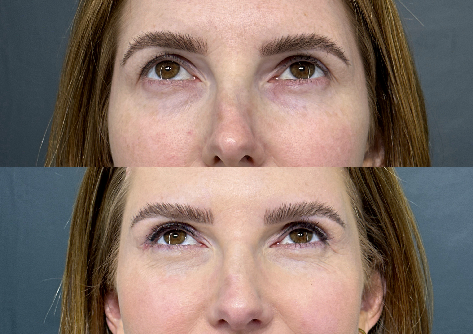 Before and after — Photo 3