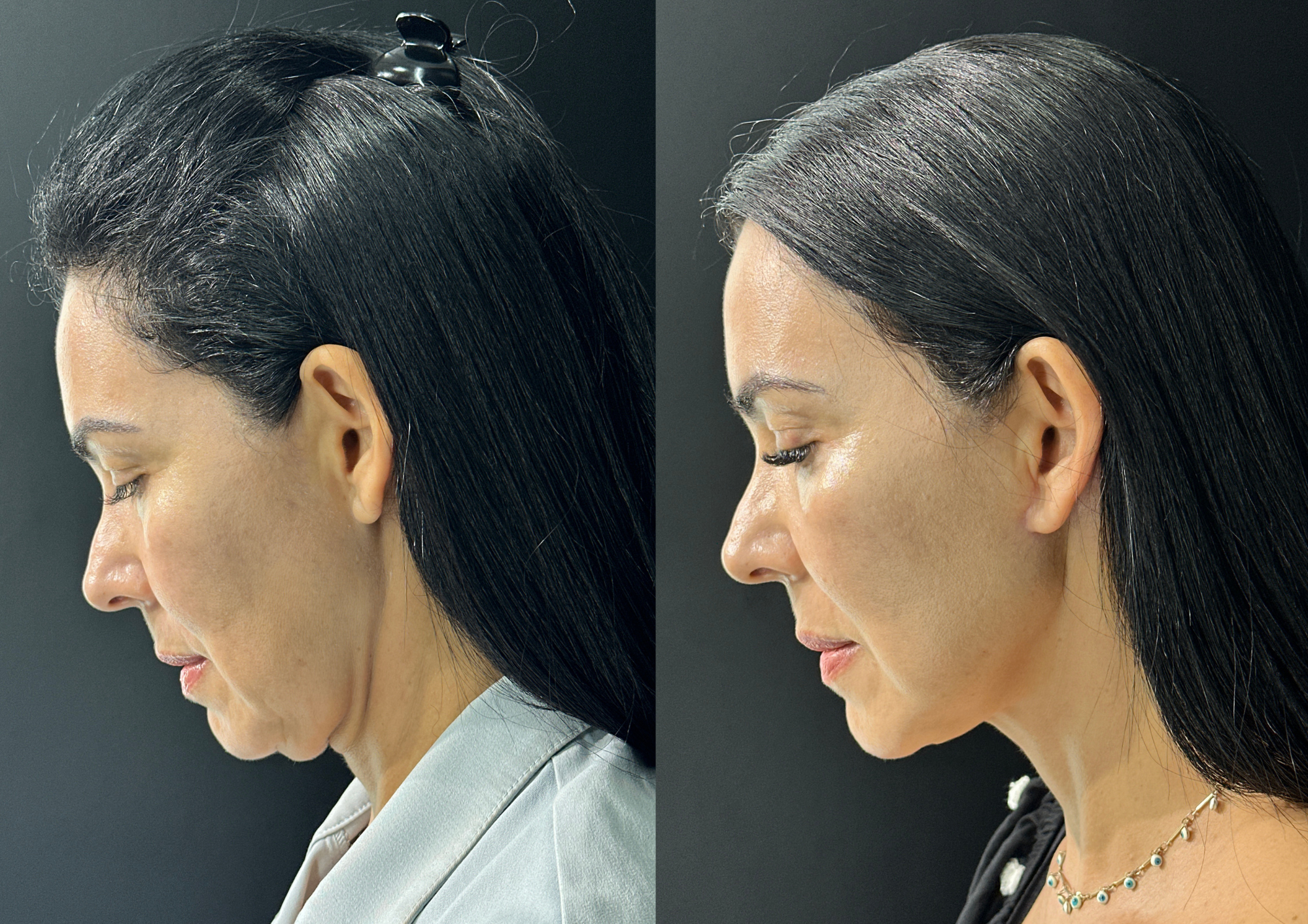 Before and after — Photo 1