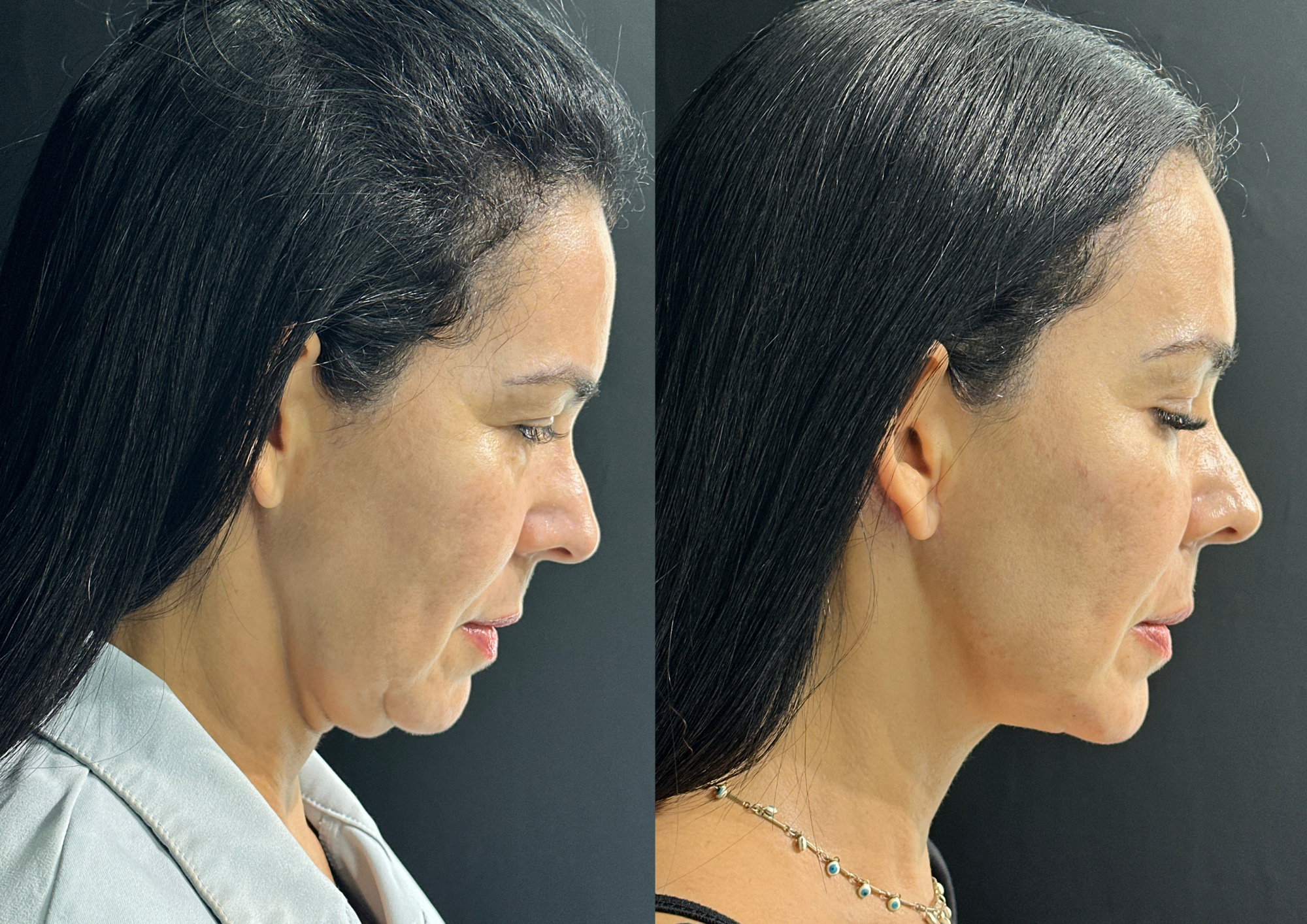 Before and after — Photo 2