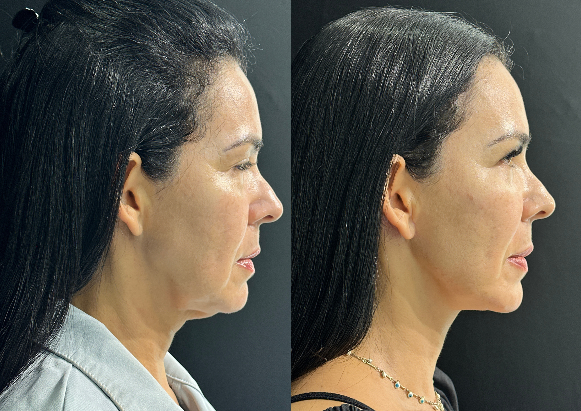 Before and after — Photo 3