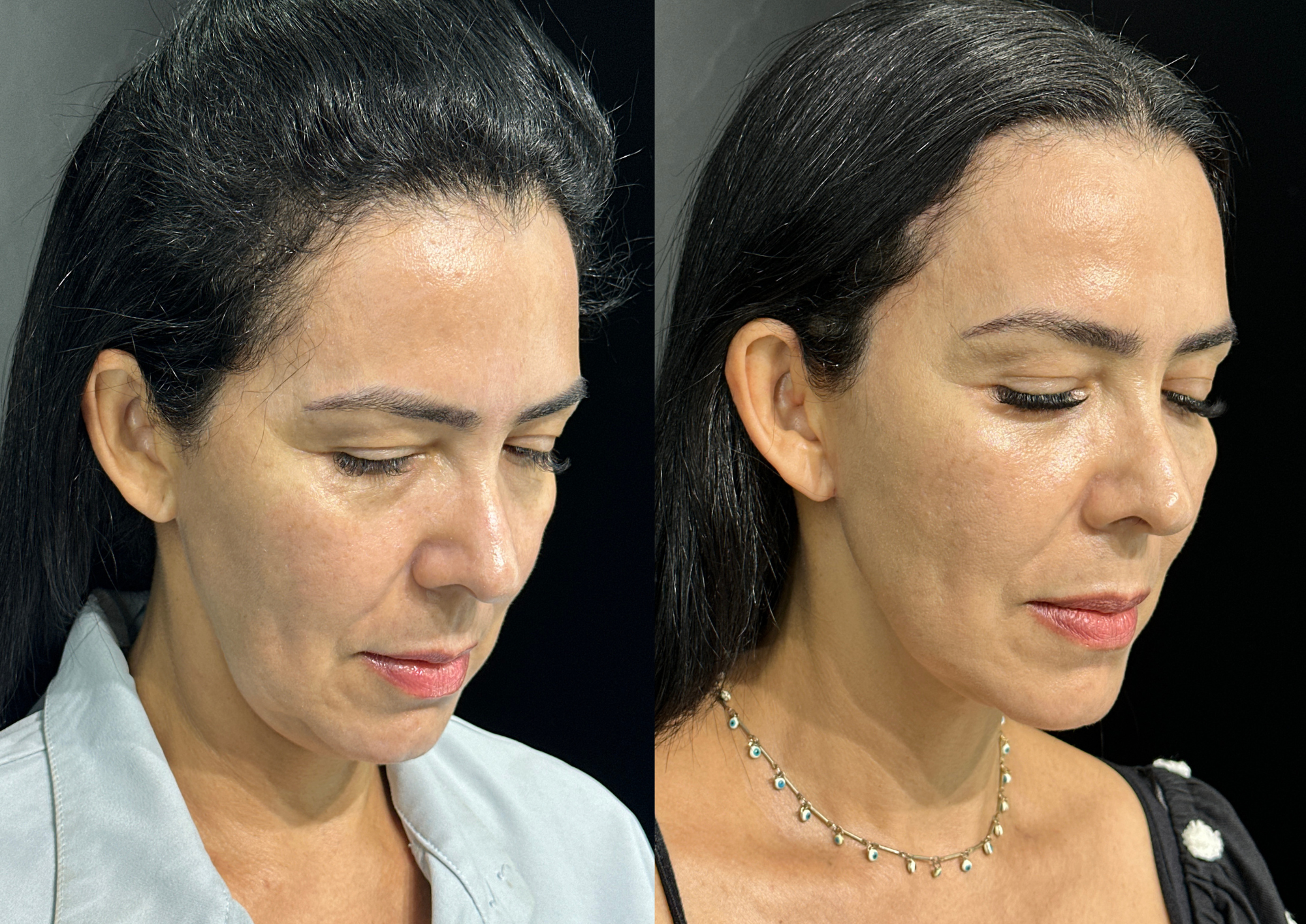 Before and after — Photo 4