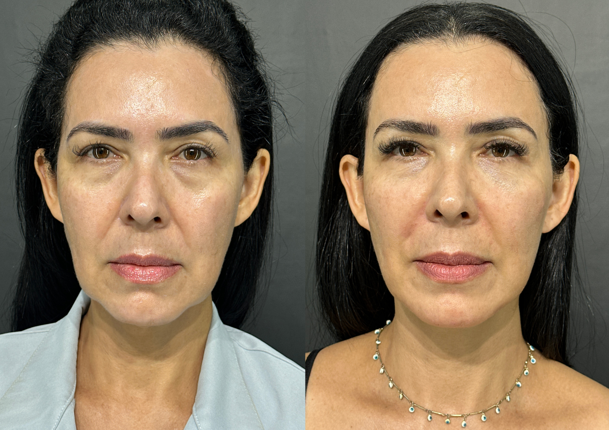 Before and after — Photo 5