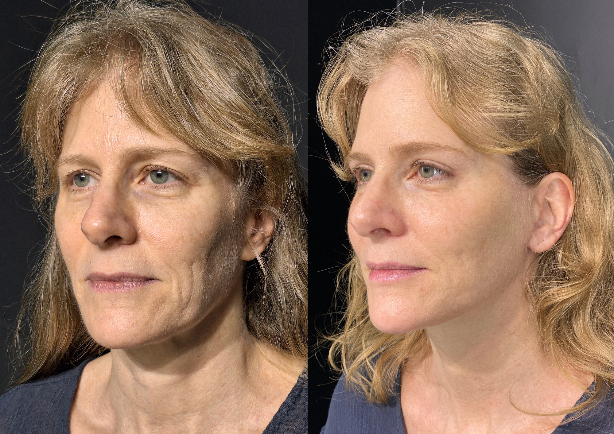Before and after — Photo 1