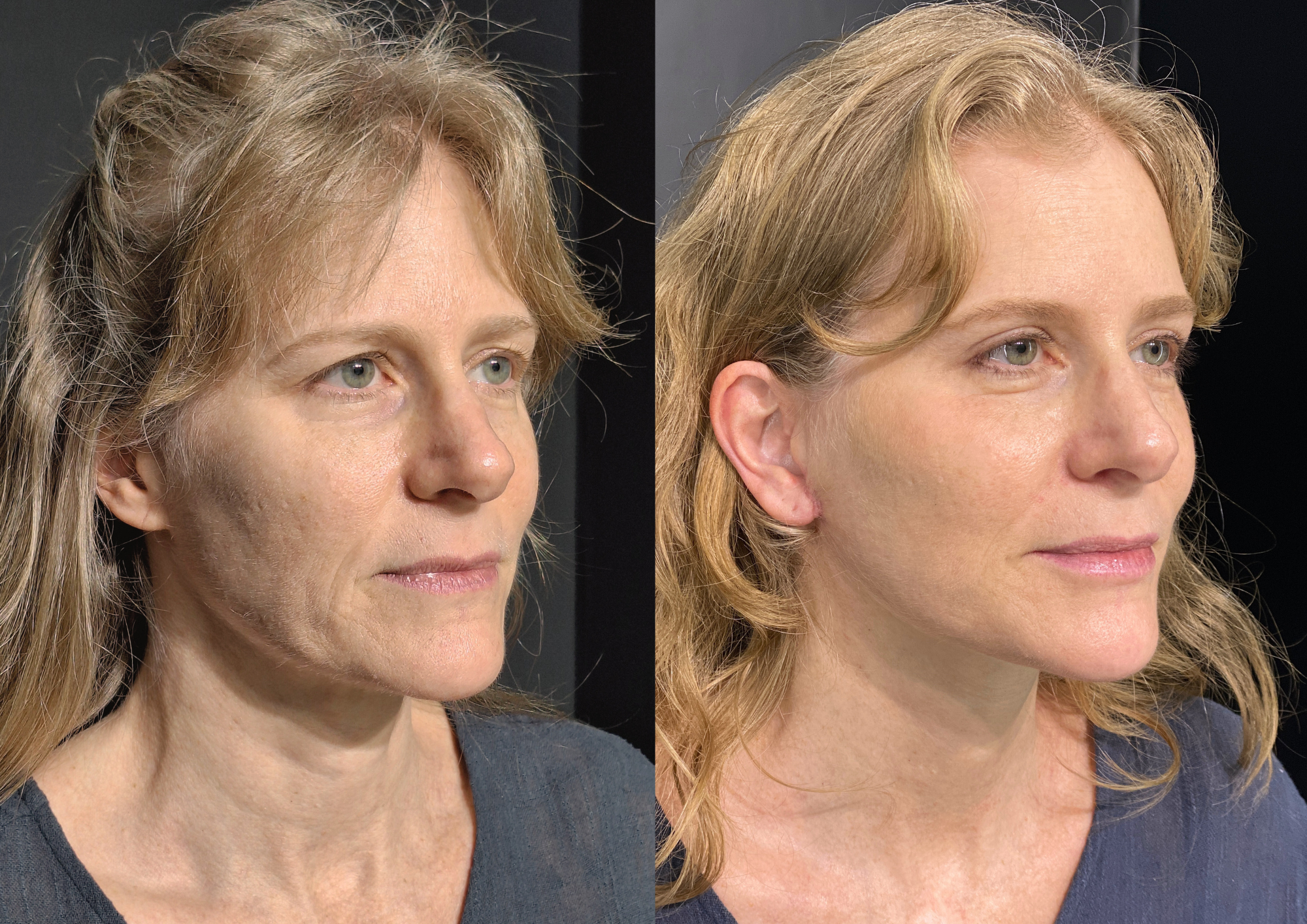 Before and after — Photo 2