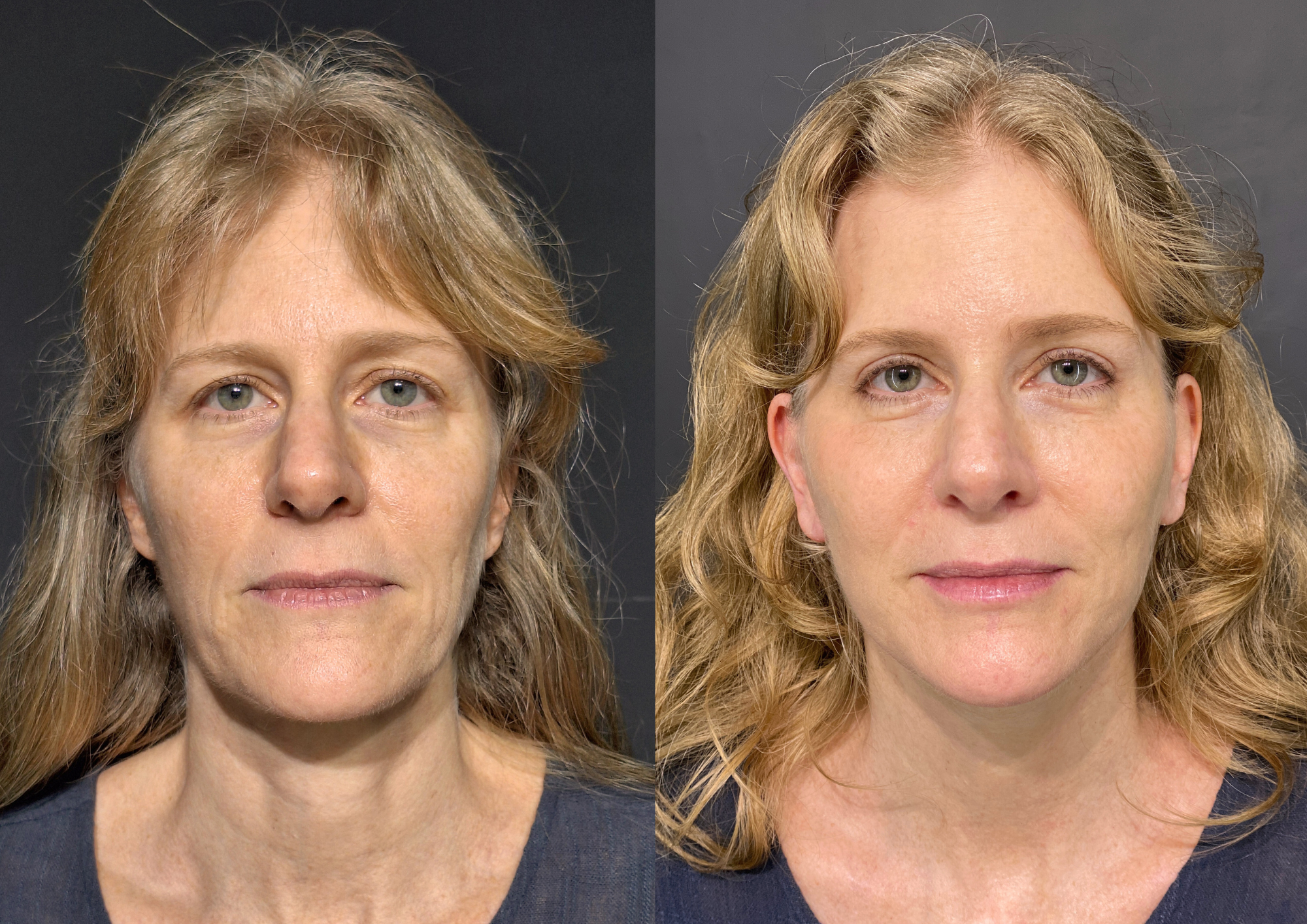 Before and after — Photo 3