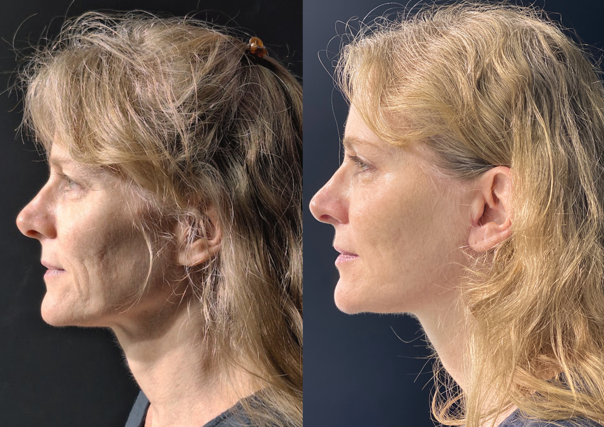 Before and after — Photo 4