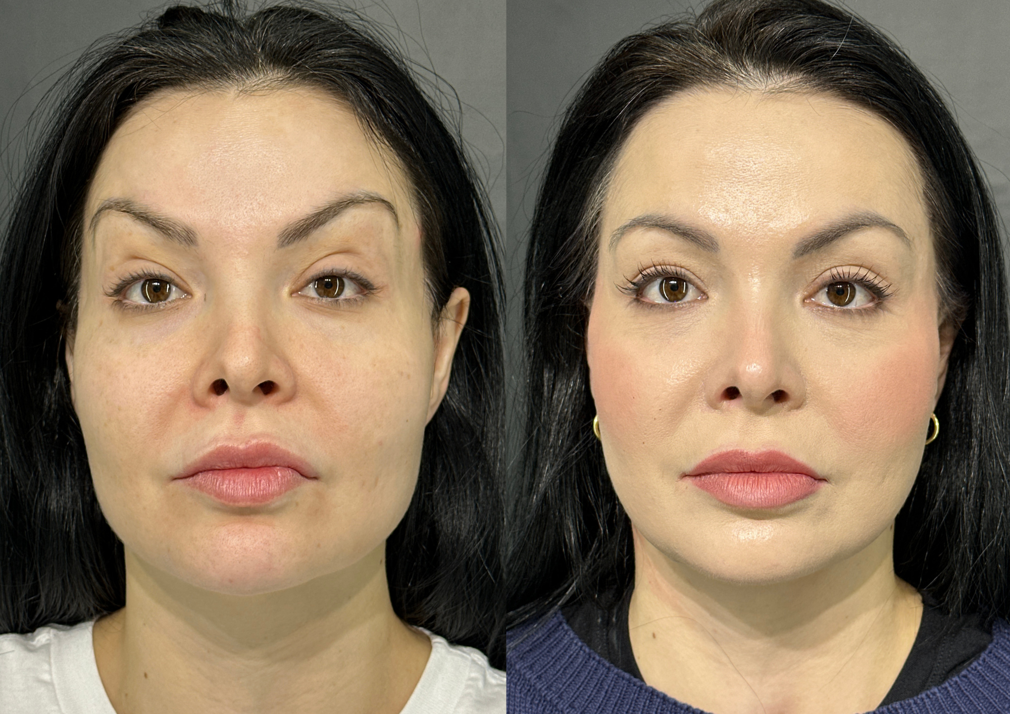 Before and after — Photo 1