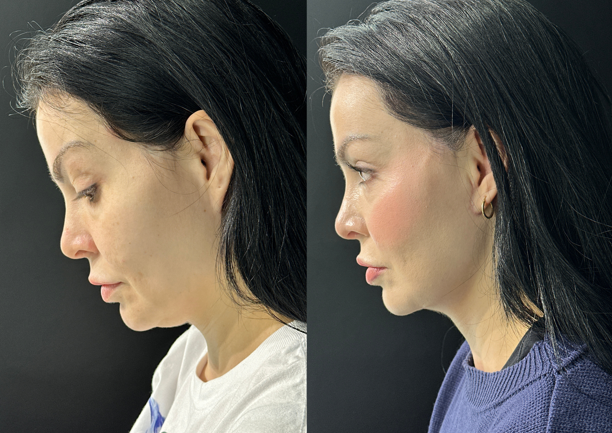 Before and after — Photo 2
