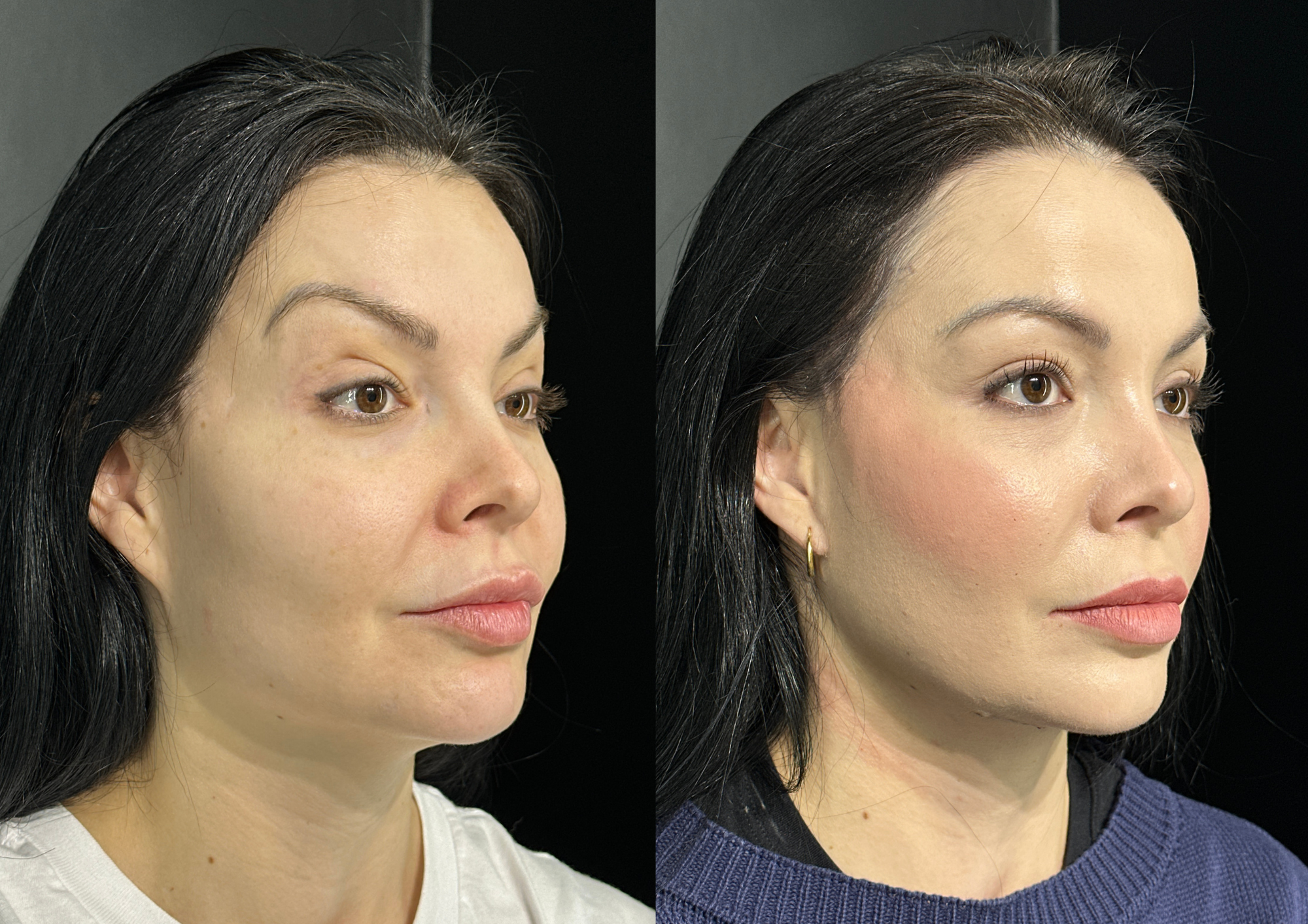 Before and after — Photo 3