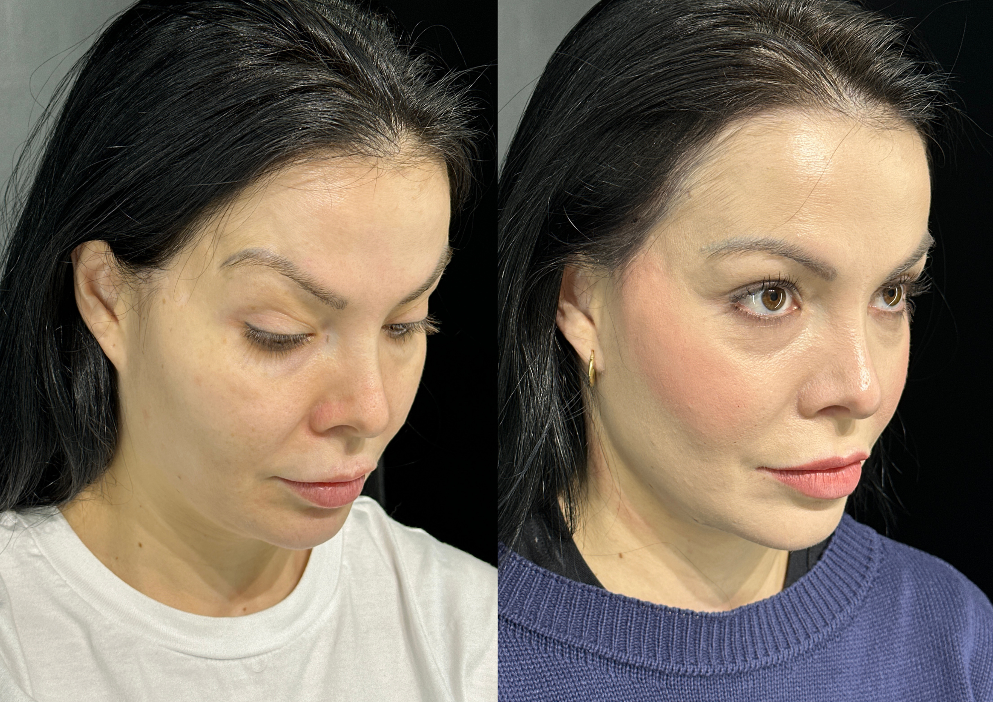 Before and after — Photo 4