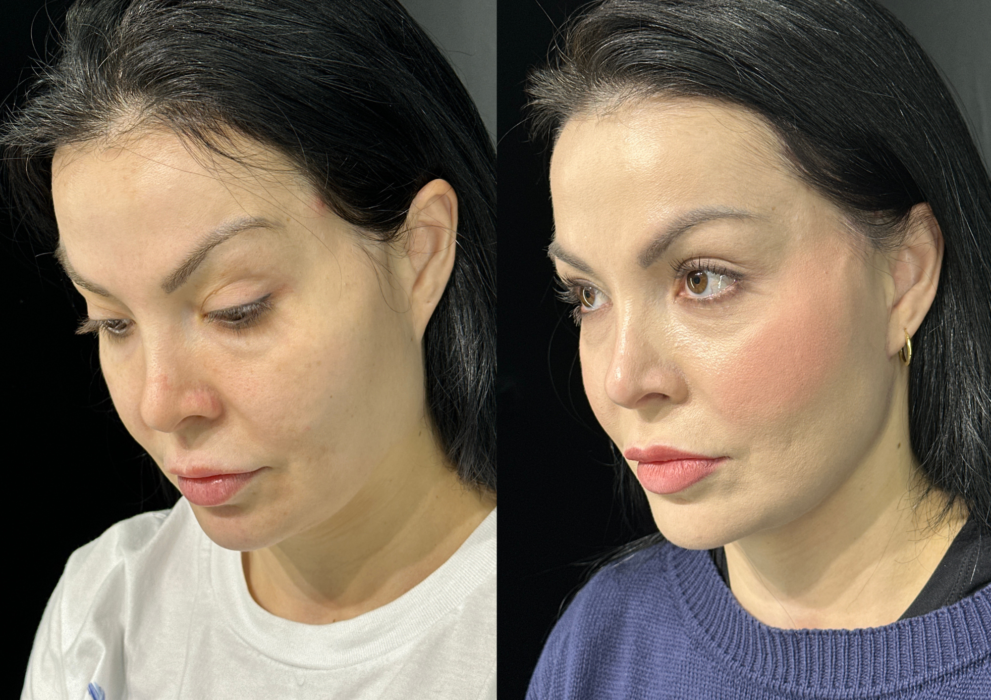 Before and after — Photo 5